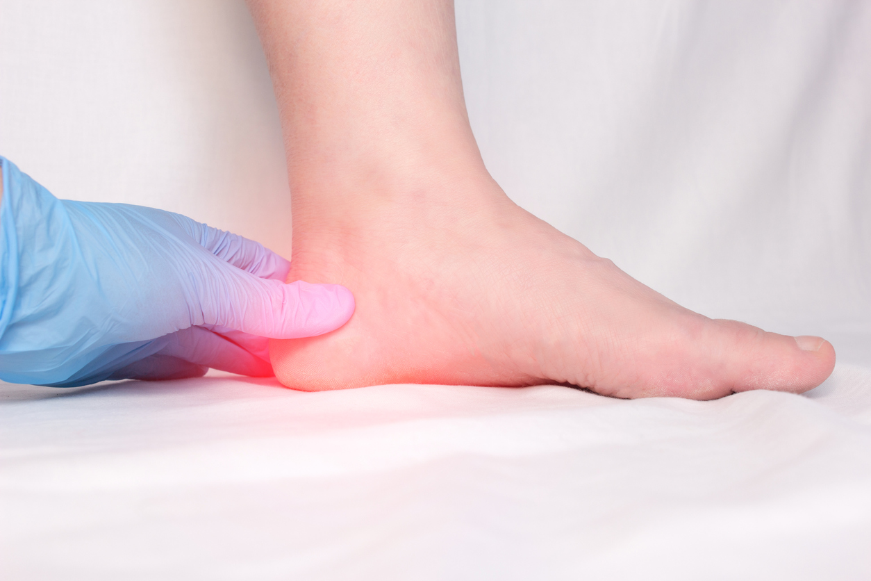 active release therapy plantar fasciitis