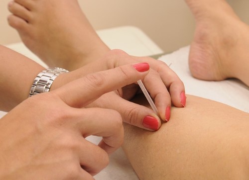 Chinese Acupuncture for Injuries, Sleep, Digestion and More!
