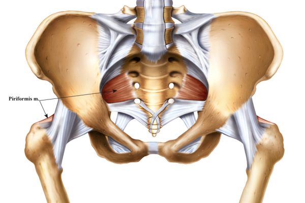 Piriformis Syndrome