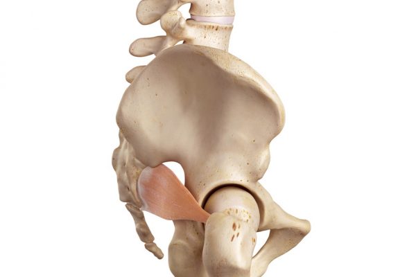 Treating Piriformis Syndrome