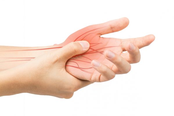Carpal Tunnel Syndrome and Treatments